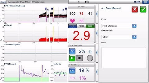 How to give a fluid challenge using LiDCO hemodynamic monitor