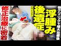【実際の症例】他クリニックで増大治療後、腫れが治らない... 2年間悩んだ男性の修正治療【モザイクなし】