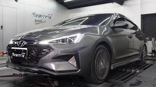 VAITRIX | Car ECU Tuning | Power Enhancement | Hyundai Elantra Sport 2020 | Customized Adjustments