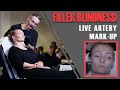 Filler Blindness! Dr Tim marks up his patient's dangerous arteries LIVE [Aesthetics Mastery Show]