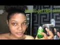 Cheap Skincare routine for both oily and dry skin/ How I get rid of acne and darkmarks