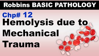 Ch12 | Hemolysis due to Mechanical Trauma | Blood Pathology | Dr Asif Lectures