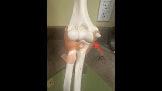 Brock Purdy s UCL Injury What To Expect