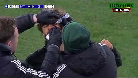 Bayern Munich vs Celtic 1-1 Highlights   All Goals 2025 HD360p