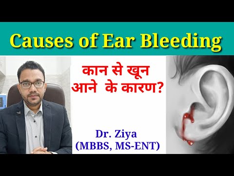 वीडियो: मेरे कान से खून क्यों बह रहा है?