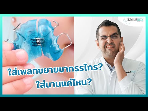 วีดีโอ: 4 วิธีในการจัดการกับเครื่องขยายเพดานปาก