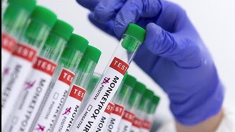 Monkeypox can be contained if we act now: WHO