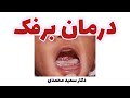 برفک دهان Oral Thrush