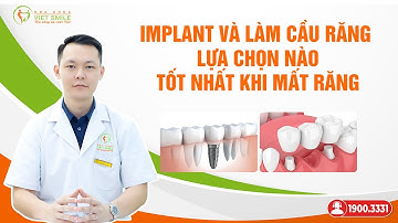 Mất răng nên chọn làm cầu răng sứ hay cấy ghép implant