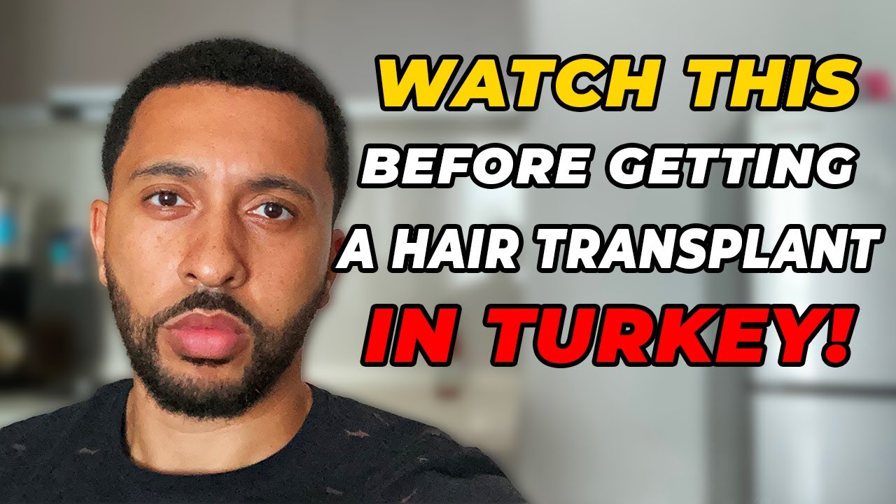 Hair Transplant Tips to Avoid Overharvesting Watch This Before Getting a Hair Transplant in Turkey!