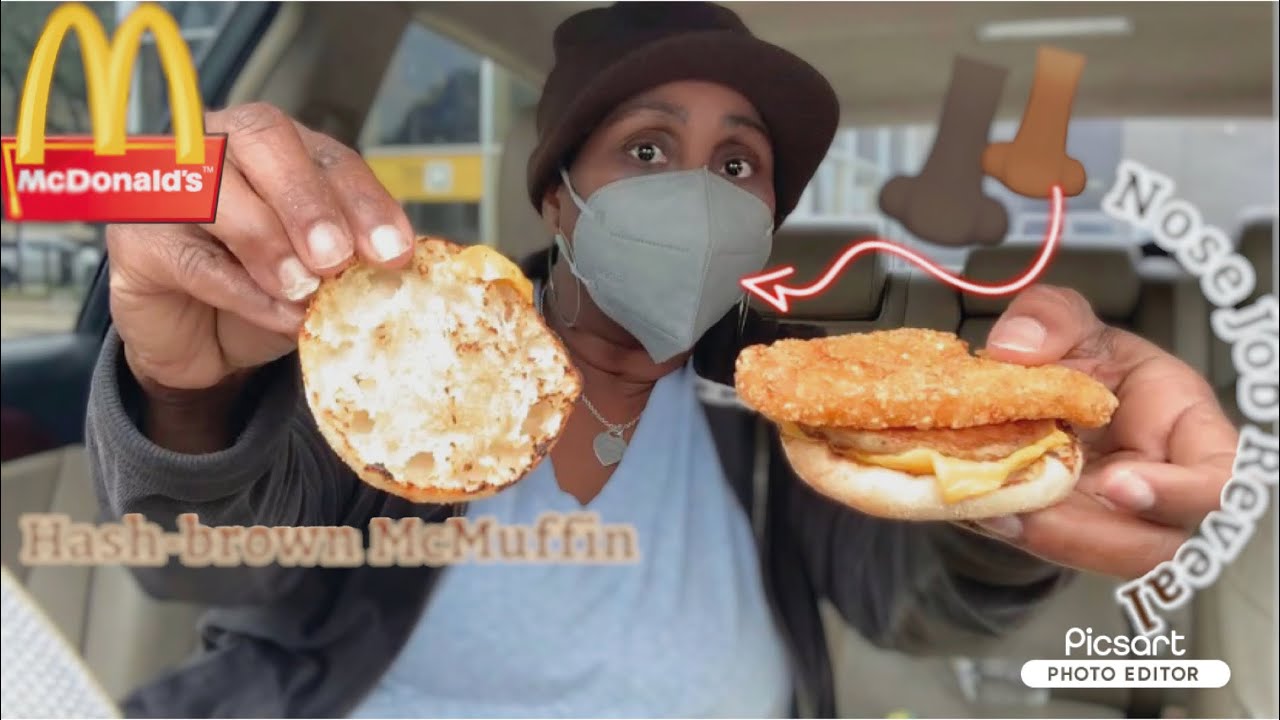 NOSE 👃🏿 JOB REVEAL | 10 Days Post-Op | MCDONALD’S NEW HASH-BROWN MCGRIDDLE HACK