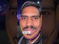 #funny#fun#trendingshort #foryou #ytshort #comedyvideo #comedy