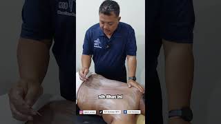 MCO ARIF HATI HATI DENGAN PENANGANAN DIAREA TULANG BELAKANG PART 4