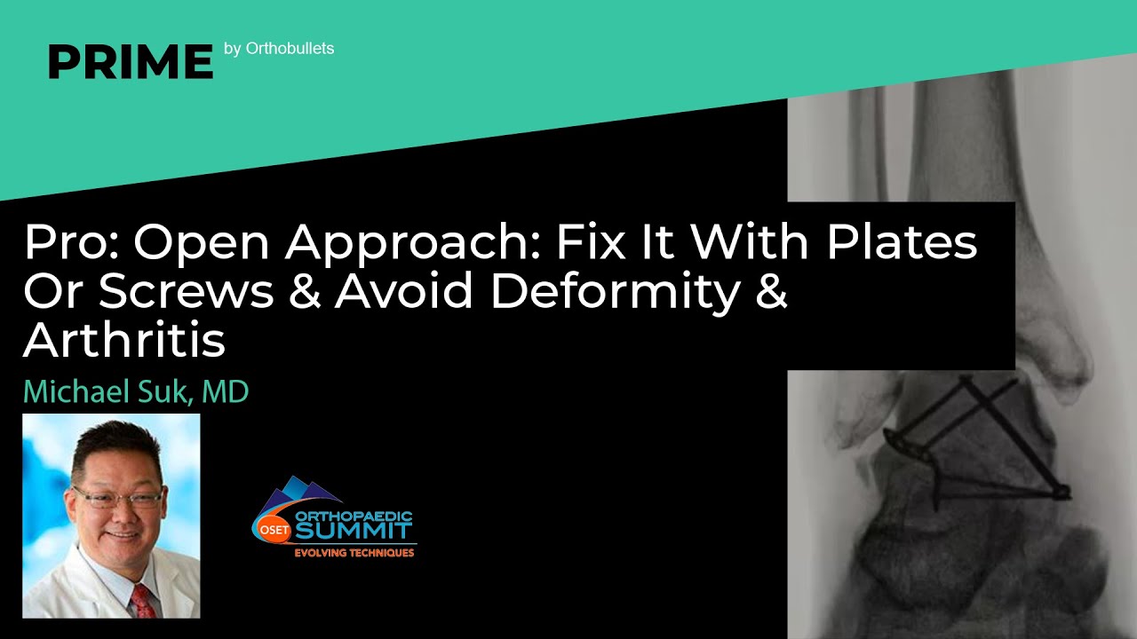 Pro: Open Approach: Fix It With Plates Or Screws & Avoid Deformity & Arthritis - Michael Suk, MD