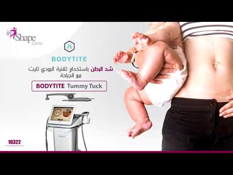 تقنية بودي تايت مع جراحة شد البطن