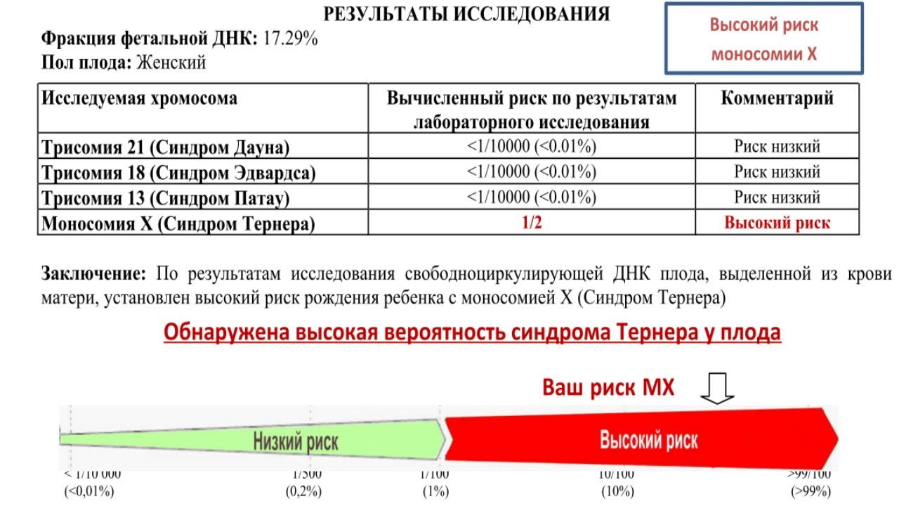 Приход результатов. НИПТ высокий риск. НИПТ синдромы. НИПТ высокие риски. НИПТ синдром Дауна.