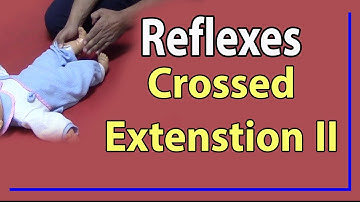 04 Crossed Extension Reflex II