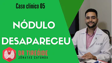 Como acabar com nódulos na garganta?