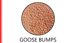 Goose Bumps