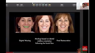 Digital Smile Design App by Ralph Georg