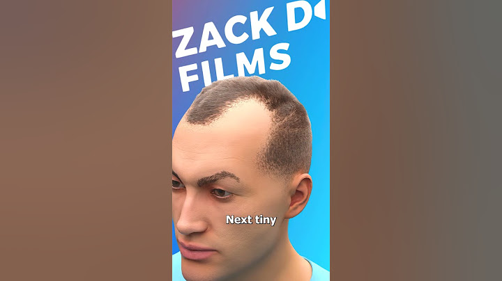 Jak fungují vlasové transplantace 🤔