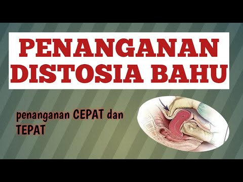 Video: Manajemen Distosia Bahu - Garis Kesehatan