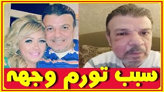 احمد سلامة يكشف امس سبب تورم وجهه وزيجاته واخرهن نجمة معروفة وبناته 7 زى القمر | اخبار النجوم