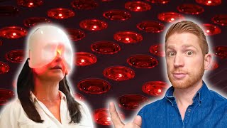 Red Light Therapy for Eye Health: Myth or Miracle?
Is red light therapy an overhyped fad that does more harm than good? Or is it a powerful tool for treating eye conditions and even reversing vision loss?
There’s some really interesting research showing how red light therapy can help your eyes, but there are also some scams and serious safety issues you need to be aware of
In this video, well break down:
- What exactly red light therapy is and how it works
- 3 ways that red light therapy can improve your eye health
- 3 potential risks and misconceptions of using red light therapy for improving your vision
- 3 guidelines for using red light therapy to get the best results safely
Red and near-infrared wavelengths of light penetrate through tissues to stimulate the mitochondria in your cells, leading to cellular repair and regeneration. This has a proven track record for things like skin treatments and helping athletes recover.
But theres a lot of research showing how red light therapy can address lots of different eye issues, including retinal issues like macular degeneration and diabetic retinopathy, dry eye syndrome, and nearsightedness (myopia).
The research in this area is still in relatively early stages, but this video seeks to give an overview of some of that research so you can decide if red light therapy is something worth looking into.
SOURCES:
- 2020 paper in The Journals of Gerontology Series A titled Optically Improved Mitochondrial Function Redeems...: https://pubmed.ncbi.nlm.nih.gov/32596723/
- 2023 paper in Retina titled PHOTOBIOMODULATION THERAPY FOR LARGE SOFT DRUSEN AND ...: https://pubmed.ncbi.nlm.nih.gov/37027819/
- 2013 paper in Investigative Ophthalmology & Visual Science titled Low-intensity far-red light inhibits early lesions that ...: https://pubmed.ncbi.nlm.nih.gov/23557732/
- 2023 paper in Cureus titled Comparison of Light-Based Devices in the Treatment of Meibomian Gland Dysfunction: https://pubmed.ncbi.nlm.nih.gov/37546127/
- 2023 paper in Journal Français dOphtalmologie titled 3-month post-procedural evaluation of a combined intense pulsed light and ...: https://pubmed.ncbi.nlm.nih.gov/37068975/
- 2024 paper in Ophthalmology titled Myopia Control Effect of Repeated Low-Level Red-Light Therapy ...: https://pubmed.ncbi.nlm.nih.gov/38763303/
- 2024 paper in BMC Ophthalmology titled A retrospective study of cumulative absolute reduction ...: https://pubmed.ncbi.nlm.nih.gov/38664659/
- 2023 paper in American Journal of Ophthalmology titled Efficacy of Repeated Low-Level Red-Light Therapy for Slowing the Progression of Childhood Myopia...: https://pubmed.ncbi.nlm.nih.gov/37030495/
- 2022 paper in Translational Vision Science & Technology titled Efficacy Comparison of Repeated Low-Level Red Light and...: https://pubmed.ncbi.nlm.nih.gov/36269184/
- Bart Wolbers 2024 webpage for Light Therapy Insiders titled Red Light Therapy For Eye Health: The Very Impressive Science: https://www.lighttherapyinsiders.com/red-light-therapy-for-eye-health/
- Joovs 2020 YouTube video titled How Does Red Light Therapy Work?
- Doctor Eye Healths 2024 YouTube video titled Red Light Therapy: Eye Health Miracle?
- Optometry Todays 2023 YouTube video titled Dry eye treatment with the Eye-Light and Topcon
- Sight Research UKs 2023 YouTube video titled Preserving sight in older age - the exciting potential of red light therapy
- National Eye Institute, NIHs YouTube videos simulating what diabetic retinopathy and macular degenerationwould look like
- WEHImoviess 2020 YouTube video titled https://www.youtube.com/watch?v=OT5AXGS1aL8
- BRIGHTSIDEs YouTube video titled What Happens Inside Your Eyes - 3D Animation
All of the background songs are instrumental versions of songs from Connor Price. Thank you for making all of your music freely available!
Here at Vision Vibes, I dive into eye-related topics ranging from astigmatism, to laser eye surgery, to the biology of your eyes.
📢 Stay Connected!
Instagram: https://www.instagram.com/visionvibescory/
TikTok: https://www.tiktok.com/@visionvibescory
SUBSCRIBE: https://www.youtube.com/user/UCDY3vVVfH-s6WgOFD0EFMBg?sub_confirmation=1
#redlighttherapy #vision #health #stem #ophthalmology #science #optometry
** Disclaimer: The information in this video is intended to serve as educational information only and is not intended or implied to be a substitute for professional medical advice, diagnosis or treatment. All content, including text, graphics, images, and information, contained in this video is for general information purposes only and does not replace a consultation with your own optometrist/ophthalmologist/health care provider. ** Red Light Therapy for Eye Health: Myth or Miracle?