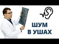 Частые причины шума в ушах и общий подход к их лечению