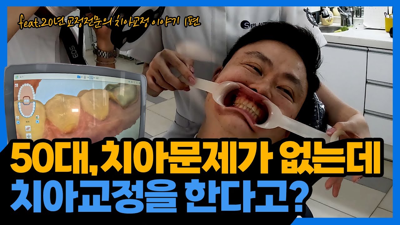 [교정일타 허원장] 50대, 치아 문제가 없는데 치아 교정을 한다고?