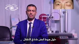 هبوط الجفن .. الأسباب والأعراض - د. مروان فرحان استشاري تجميل العيون والأورام.