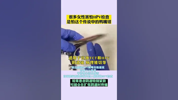 阴道检查用鸭嘴钳 #自然疗法 #医学科普 #中医 - 天天要闻