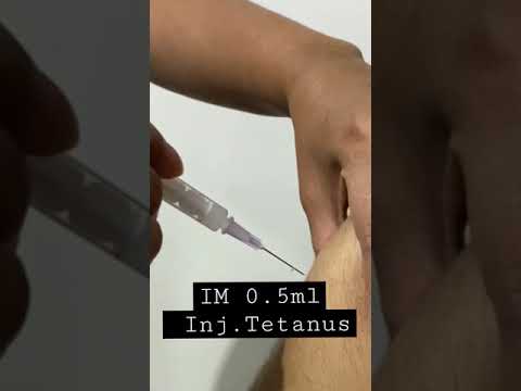 Video: Di mana menyuntikkan toksoid tetanus?