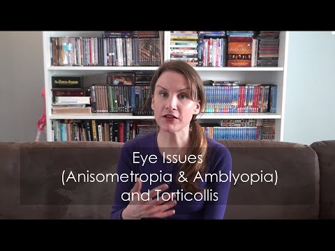 Video: Anisometropiki amblyopia ni nini?