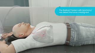 Treating Lung Tumors with the #Radixact® System with Synchrony®