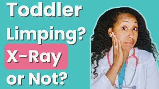 My Toddler Fell and Has a Limp—Does She Need an X-Ray?