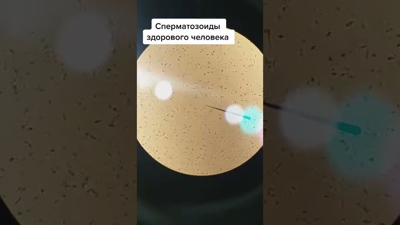 очень густая и липкая сперма