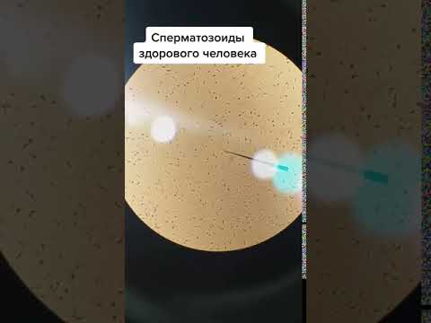 Сравнение сперматозойды курящего и не курящего человека