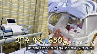 27주 4일, 650g으로 태어난 내 아기🤍•고위험 산모 입원&출산 이야기•탯줄 혈류 이상•자궁 내 성장지연•이른둥이 출산•둘째 전신마취 제왕절개 출산