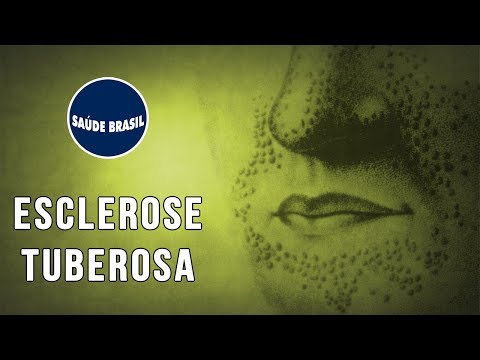 ESCLEROSE TUBEROSA | SÉRIE SAÚDE BRASIL