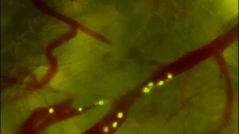 Intravital microscopy of HT1080-GFP tagged fibrosacroma tumour cells rolling