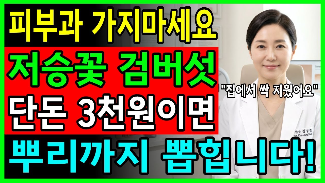 집에서 검버섯 없애는 방법 5가지! 피부과에서 비싼 돈 쓰지마세요! 집에서 검버섯,기미 뿌리까지 싹 다 사라집니다! | 검버섯 | 시니어 피부 | 시니어 건강