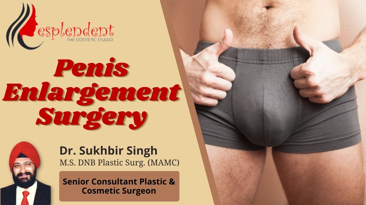 Penis Enlargement Surgery Treatment in Hindi ||  लिंग का आकार कैसे बड़ा करें || Dr. Sukhbir Singh