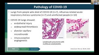 Multidimenstional Challenges of COVID-19, Including COVID-19 and HIV