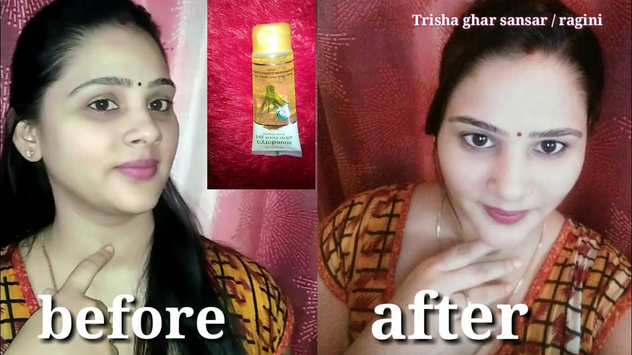 How to use PATANJALI SAUNDARYA ALOE VERA GEL KESAR CHANDAN ON FACE