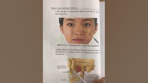 Học tiêm Filler & botox: Giải phẫu mạch máu và cách tránh mạch máu khi tiêm filler