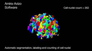 Amira Software | Automated cell nuclei count in 3D spheroid models screenshot 4