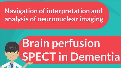 Brain perfusion SPECT in Dementia