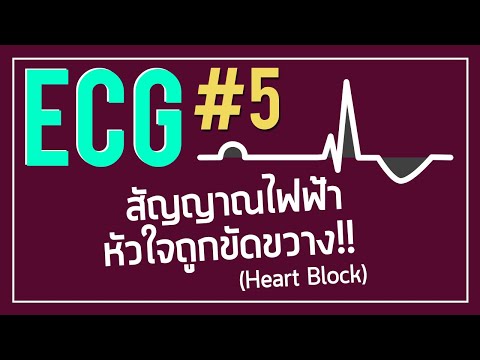 วีดีโอ: Heart Block หรือ Conduction Delay (ด้านหน้าซ้าย) ใน Cats