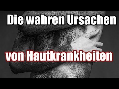 Was dir dein Arzt nicht sagt - Die wahren Ursachen von Hautkrankheiten (Teil 1/2)